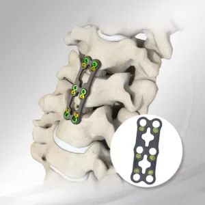 Anterior Cervical Spine Fixation System