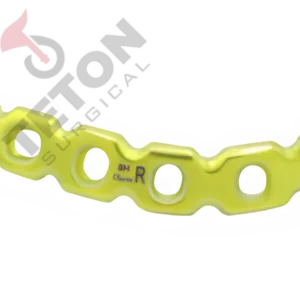 Anatomical Acetabular Locking Plate – Left/Right (6, 8, 10 Holes) | Compatible with 3.5mm Locking, Cortical & 4.0mm Cancellous Screws